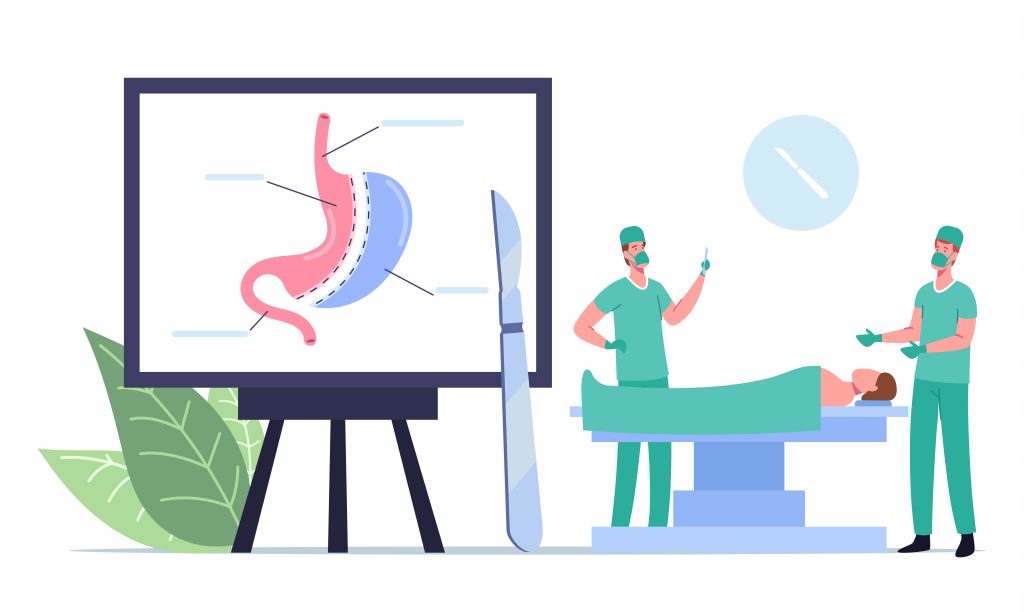 Medical Operable Weight Loss Procedure. Surgeon Male Characters Make Operation Bariatric Surgery Stomach Reduction